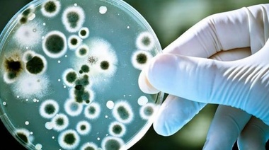 Streptococcus Pyogenes: Informe de la Facultad de Ciencias Exactas de la UNLP