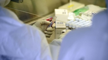 Argentina recibió 250.000 test PCR para diagnóstico de coronavirus y se confirmaron 167 muertes