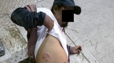 A cien metros del Obelisco, un hombre apuñalado estuvo 38 minutos para que lo atienda una ambulancia