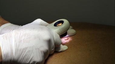 El Municipio se sumó a la campaña contra el Cáncer de Piel y realizó controles dermatológicos