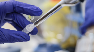 Casos de viruela símica se elevan a 32 en Argentina